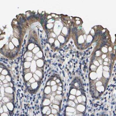 Immunohistochemistry: TRAF-6 Antibody [NBP1-80825]