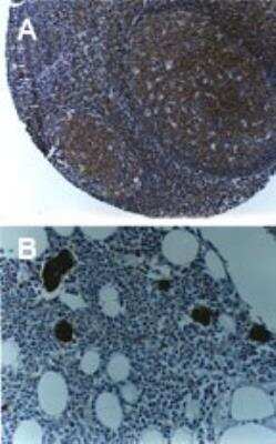 Immunohistochemistry-Paraffin: TRAF-6 Antibody [NB100-56179]