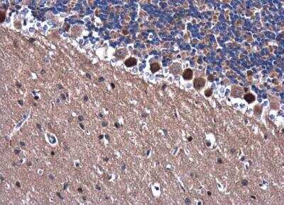 Immunohistochemistry-Paraffin: TRAF-6 Antibody [NBP1-33357]