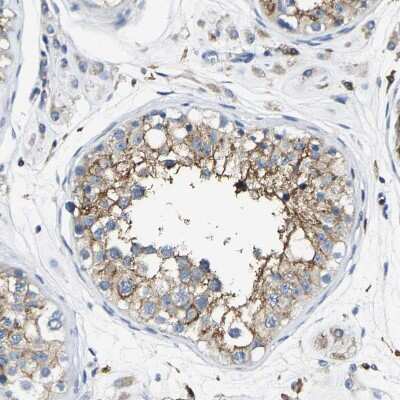 Immunohistochemistry-Paraffin: TRAF-6 Antibody [NBP1-80825]