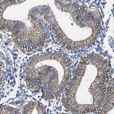 Immunohistochemistry-Paraffin: TRAF-6 Antibody [NBP1-80825]
