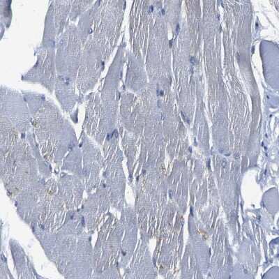 Immunohistochemistry-Paraffin: TRAF-6 Antibody [NBP1-80825]