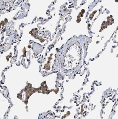 Immunohistochemistry-Paraffin: TRAF-6 Antibody [NBP1-80826]