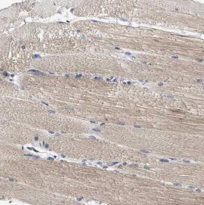 Immunohistochemistry-Paraffin: TRAF-6 Antibody [NBP1-80826]
