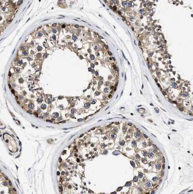 Immunohistochemistry-Paraffin: TRAF-6 Antibody [NBP1-80826]