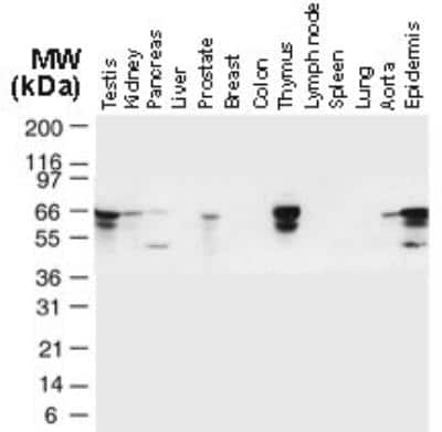 Western Blot: TRAF-6 Antibody [NB100-56179]