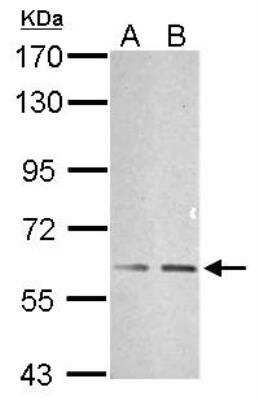 Western Blot: TRAF-6 Antibody [NBP1-33357]
