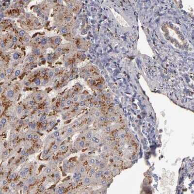 Immunohistochemistry-Paraffin: TRAF-1 Antibody [NBP1-84920]