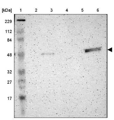 Western Blot: TRAF-1 Antibody [NBP1-84920]