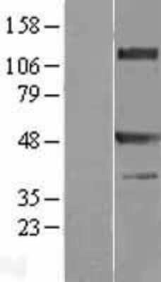 Western Blot: TRAF-1 Overexpression Lysate [NBL1-17239]