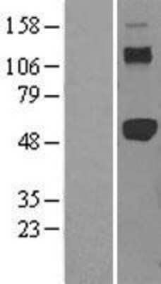 Western Blot: TRAF-2 Overexpression Lysate [NBL1-17240]