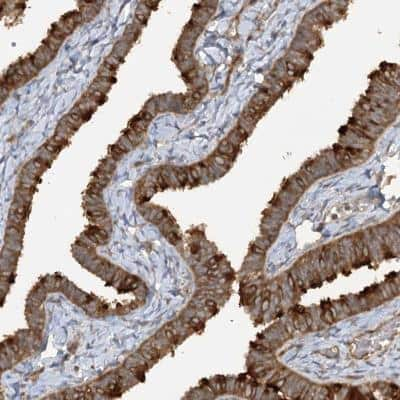 Immunohistochemistry-Paraffin: TRAF3IP1 Antibody [NBP1-84195]