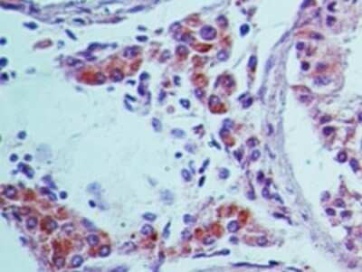 Immunohistochemistry-Paraffin: TRAF3IP1 Antibody [NBP2-14847]