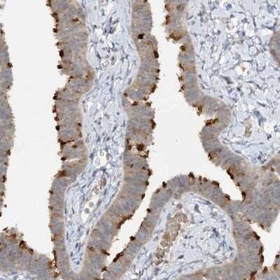 Immunohistochemistry-Paraffin: TRAF3IP1 Antibody [NBP2-32704]