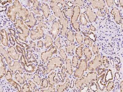 Immunohistochemistry-Paraffin: TRAF3IP1 Antibody [NBP2-97341]