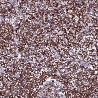 Immunohistochemistry-Paraffin: TRAF3IP3 Antibody [NBP1-86974]