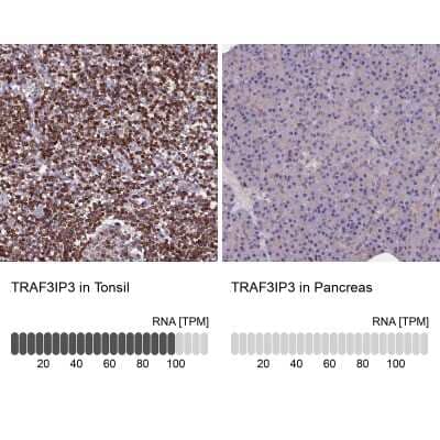 Immunohistochemistry-Paraffin: TRAF3IP3 Antibody [NBP1-86974]