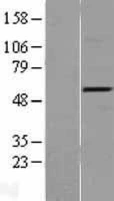 Western Blot: TRAF-4 Overexpression Lysate [NBL1-17244]