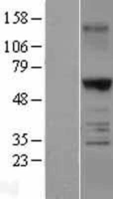 Western Blot: TRAF-6 Overexpression Lysate [NBL1-17247]