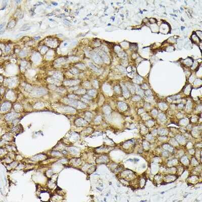 Immunohistochemistry-Paraffin: TRAF7 Antibody - Azide and BSA Free [NBP3-04330]