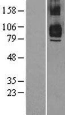 Western Blot: TRAF7 Overexpression Lysate [NBL1-17248]