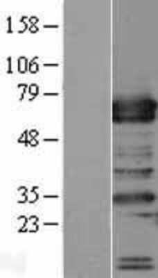 Western Blot: TRAFD1 Overexpression Lysate [NBP2-09698]