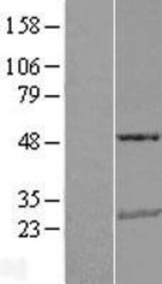 Western Blot: TRAIL/TNFSF10 Overexpression Lysate [NBL1-17161]