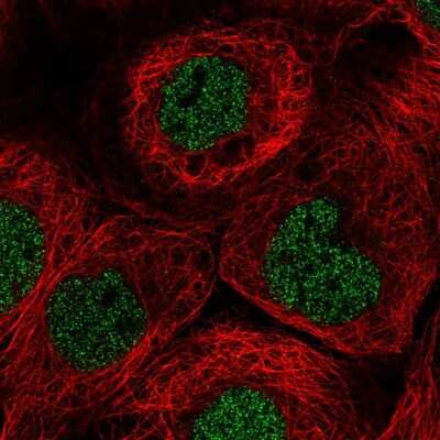 Immunocytochemistry/ Immunofluorescence: TRAILR1/TNFRSF10A Antibody [NBP2-56818]