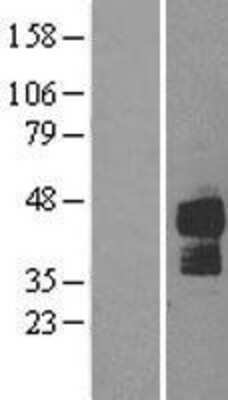 Western Blot: TRAILR2/TNFRSF10B Overexpression Lysate [NBL1-17142]