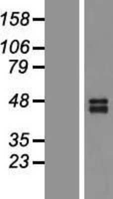 Western Blot: TRAILR2/TNFRSF10B Overexpression Lysate [NBP2-05437]