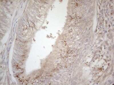 Immunohistochemistry: TRAILR2/TNFRSF10B Antibody (OTI2A5) [NBP2-46148]