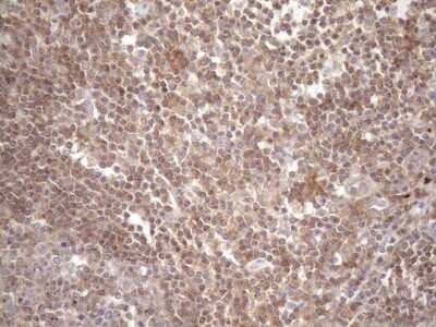 Immunohistochemistry: TRAILR2/TNFRSF10B Antibody (OTI2A5) [NBP2-46148]