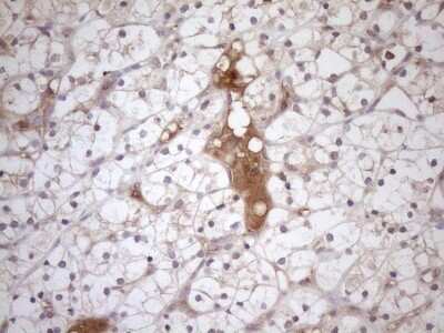 Immunohistochemistry: TRAILR2/TNFRSF10B Antibody (OTI2A5) [NBP2-46148]