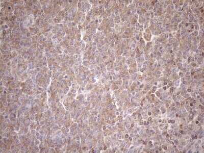 Immunohistochemistry: TRAILR2/TNFRSF10B Antibody (OTI2A5) [NBP2-46148]