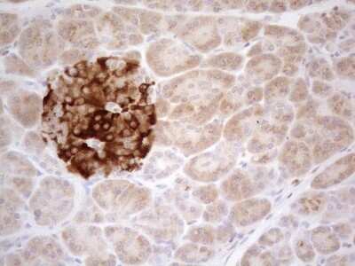 Immunohistochemistry: TRAILR2/TNFRSF10B Antibody (OTI2A5) [NBP2-46148]