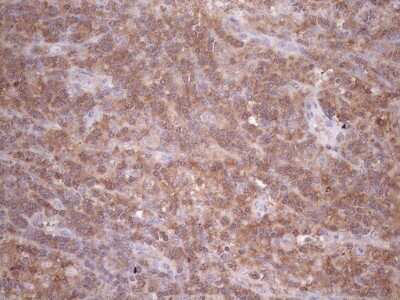 Immunohistochemistry: TRAILR2/TNFRSF10B Antibody (OTI2A5) [NBP2-46148]