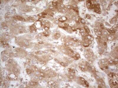 Immunohistochemistry: TRAILR2/TNFRSF10B Antibody (OTI2A5) [NBP2-46148]