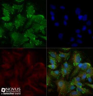 Immunocytochemistry/ Immunofluorescence: TRAILR2/TNFRSF10B Antibody [NB100-56618]