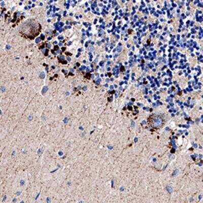 Immunohistochemistry-Paraffin: TRAILR2/TNFRSF10B Antibody [NB100-56618]