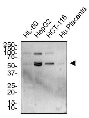 Western Blot: TRAILR2/TNFRSF10B Antibody [NB100-56618]