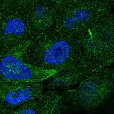 Immunocytochemistry/ Immunofluorescence: TRAIL/TNFSF10 Antibody [NBP2-38744]