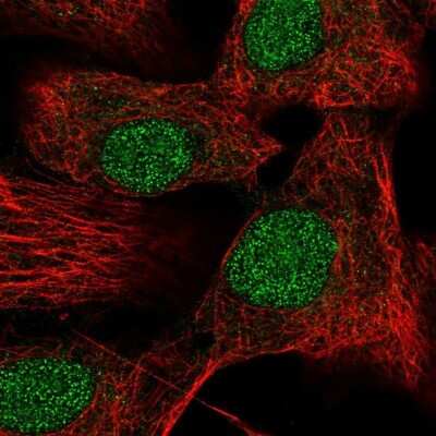 Immunocytochemistry/ Immunofluorescence: TRAILR1/TNFRSF10A Antibody [NBP2-33716]