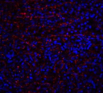 Immunohistochemistry: TRAILR1/TNFRSF10A Antibody - BSA Free [NBP2-25092]