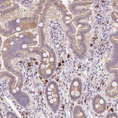 Immunohistochemistry-Paraffin: TRAILR1/TNFRSF10A Antibody [NBP2-33716]