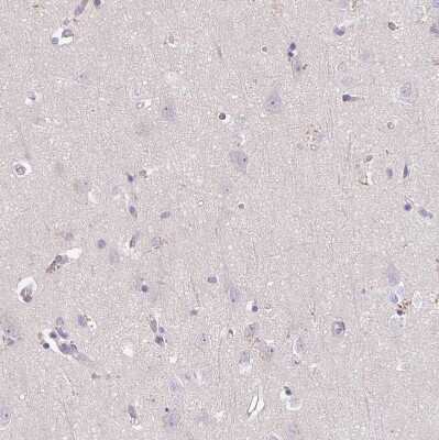 Immunohistochemistry-Paraffin: TRAILR1/TNFRSF10A Antibody [NBP2-33716]