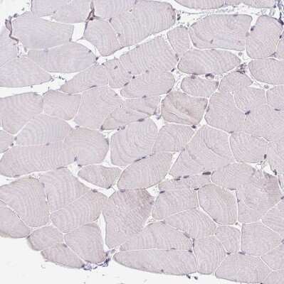 Immunohistochemistry-Paraffin: TRAILR1/TNFRSF10A Antibody [NBP2-33716]