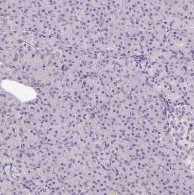 Immunohistochemistry-Paraffin: TRAILR1/TNFRSF10A Antibody [NBP2-33716]
