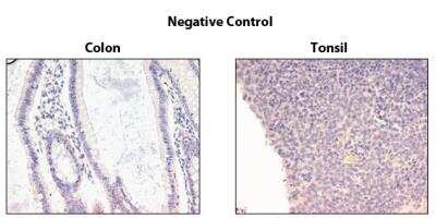 Immunohistochemistry-Paraffin: TRAILR1/TNFRSF10A Antibody (TR1.02) - BSA Free [NBP2-80069]