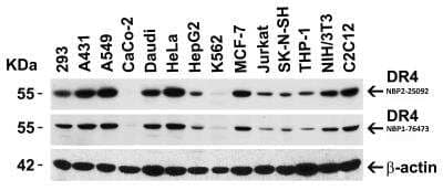 Western Blot: TRAILR1/TNFRSF10A AntibodyBSA Free [NBP2-25092]