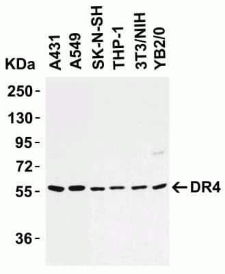 Western Blot: TRAILR1/TNFRSF10A AntibodyBSA Free [NBP2-25092]